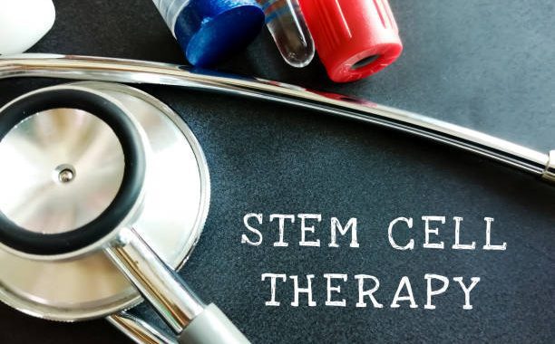Debunking Myths That Are Related To Stem Cell Therapy For Good!